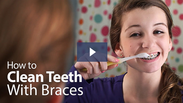 Braces in Charles County and St. Mary’s County, MD